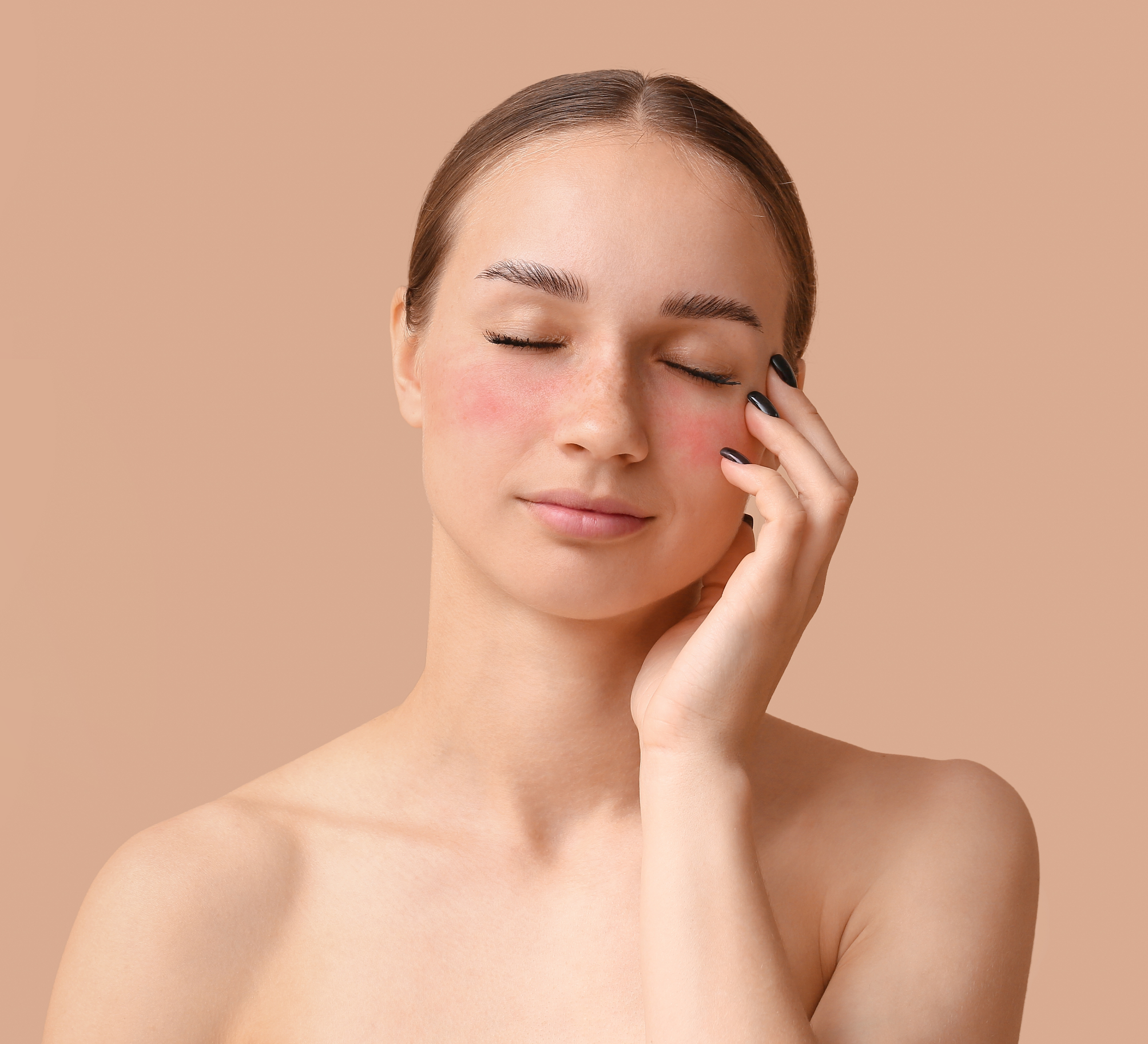 Érzékeny, rozáceás